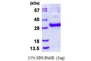 Image no. 1 for Thymidine Kinase 1, Soluble (TK1) protein (His tag) (ABIN1098640) (TK1 Protein (His tag))
