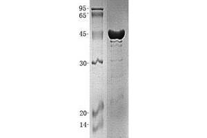 Validation with Western Blot (Glutathione Synthetase Protein (GSS) (His tag))