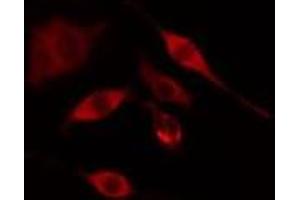 ABIN6275309 staining COLO205 cells by IF/ICC. (PNPLA6 antibody  (Internal Region))