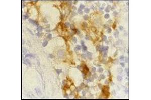 Immunohistochemistry (IHC) image for anti-CD209 (CD209) (Extracellular Domain) antibody (ABIN492511) (DC-SIGN/CD209 antibody  (Extracellular Domain))