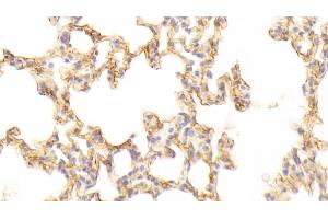 Immunohistochemistry (IHC) image for anti-Intercellular Adhesion Molecule 1 (ICAM1) (AA 328-465) antibody (ABIN7438136)