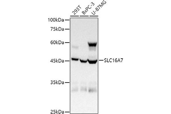 SLC16A7 antibody  (C-Term)