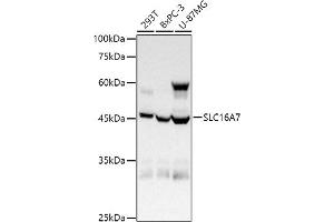 Western blot analysis of extracts of various cell lines, using (ABIN6134859, ABIN6147861, ABIN6147862 and ABIN6215999) at 1:1000 dilution.