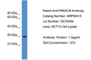 WB Suggested Anti-PRKACB  Antibody Titration: 0. (PRKACB antibody  (N-Term))