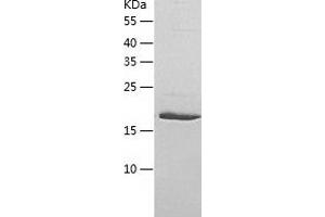 Western Blotting (WB) image for UL16 Binding Protein 1 (ULBP1) (AA 26-216) protein (His tag) (ABIN7125651) (ULBP1 Protein (AA 26-216) (His tag))