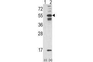 Western Blotting (WB) image for anti-Calcium/calmodulin-Dependent Protein Kinase II alpha (CAMK2A) antibody (ABIN3003199) (CAMK2A antibody)