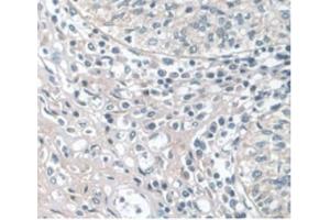 Detection of APOA1 in Human Prostate Gland Tissue using Monoclonal Antibody to Apolipoprotein A1 (APOA1) (APOA1 antibody  (AA 122-267))