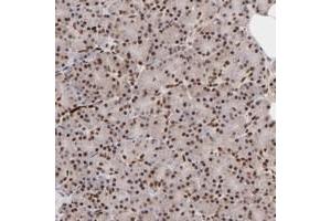 Immunohistochemical staining of human pancreas with ZFX polyclonal antibody  shows strong nuclear positivity in exocrine glandular cells at 1:200-1:500 dilution. (ZFX antibody)