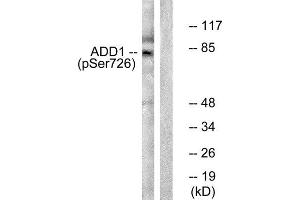 Western Blotting (WB) image for anti-Adducin 1 (Alpha) (ADD1) (pSer726) antibody (ABIN1847203) (alpha Adducin antibody  (pSer726))