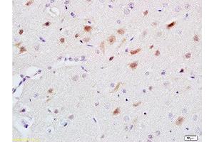 Formalin-fixed and paraffin embedded rat brain labeled with Anti-5-HT Polyclonal Antibody, Unconjugated  at 1:200 followed by conjugation to the secondary antibody and DAB staining. (Serotonin antibody)