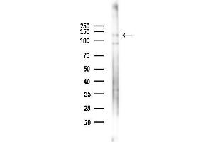 Western blot analysis of lysates from EC304 cells(heat-shock,45 min treatment), using Phospho-eNOS (Thr495) Antibody at 1/1000 dilution.