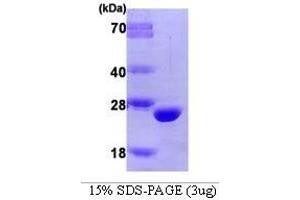 Figure annotation denotes ug of protein loaded and % gel used. (Catechol-O-Methyltransferase (COMT) (AA 51-271) Peptide)
