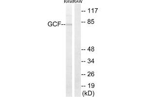Western Blotting (WB) image for anti-GC-Rich Sequence DNA-Binding Factor 2 (GCFC2) (Internal Region) antibody (ABIN1851368)