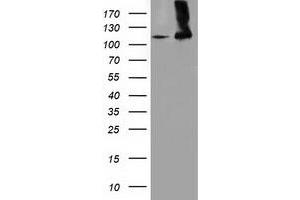 HEK293T cells were transfected with the pCMV6-ENTRY control (Left lane) or pCMV6-ENTRY MICAL1 (Right lane) cDNA for 48 hrs and lysed. (MICAL1 antibody)