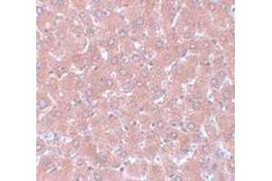 Immunohistochemistry (IHC) image for anti-Nsa1p (NSA1) (C-Term) antibody (ABIN1030550)