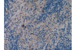 Immunohistochemistry (IHC) image for anti-Toll-Like Receptor 4 (TLR4) (AA 49-247) antibody (ABIN7432529)