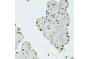 Immunohistochemistry (IHC) image for anti-FIP1 Like 1 (FIP1L1) (AA 1-300) antibody (ABIN6140640)