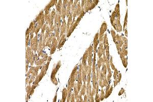 Immunohistochemistry of paraffin-embedded rat heart using PDGFB Rabbit pAb (ABIN3021688, ABIN3021689, ABIN3021690 and ABIN6215511) at dilution of 1:150 (40x lens). (PDGFB antibody  (AA 20-241))