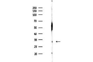 anti-BTB (POZ) Domain Containing 8 (BTBD8) antibody