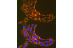 Immunofluorescence (IF) image for anti-Ribosomal Protein S20 (RPS20) antibody (ABIN7270017)