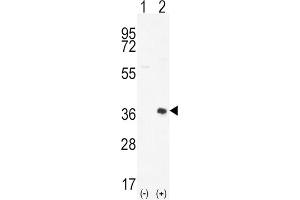 Western Blotting (WB) image for anti-Proto-Oncogene Pim-2 (Serine Threonine Kinase) (PIM2) antibody (ABIN3003584) (PIM2 antibody)