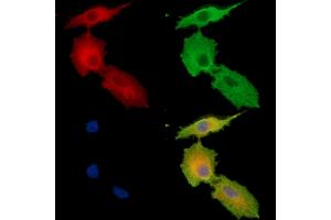 ABIN7096181 and ABIN7100243 staining  cells by IF/ICC.