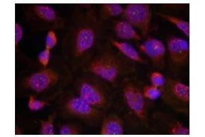 Image no. 1 for anti-B-Cell CLL/lymphoma 2 (BCL2) (Ser70) antibody (ABIN197204) (Bcl-2 antibody  (Ser70))