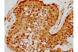 IHC image of ABIN7168107 diluted at 1:300 and staining in paraffin-embedded human testis tissue performed on a Leica BondTM system. (RNASEH2A antibody  (AA 201-299))