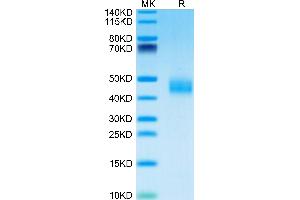 Mouse Galectin 3 on Tris-Bis PAGE under reduced condition. (Galectin 3 Protein (LGALS3) (AA 2-264) (His tag))