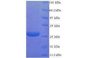SDS-PAGE (SDS) image for Retinoschisin 1 (RS1) (AA 24-224) protein (His tag) (ABIN5710286) (RS1 Protein (AA 24-224) (His tag))