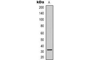 Western blot analysis of CCNB1IP1 expression in Jurkat (A) whole cell lysates. (CCNB1IP1 antibody  (C-Term))