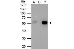 IP Image TAF7 antibody immunoprecipitates TAF7 protein in IP experiments. (TAF7 antibody  (Center))