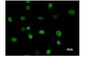 Immunostaining analysis in HeLa cells. (SATB2 antibody)