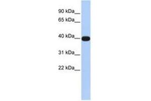 Image no. 1 for anti-LIM Homeobox Transcription Factor 1, alpha (LMX1A) (N-Term) antibody (ABIN6740305) (LMX1A antibody  (N-Term))