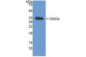 Western blot analysis of recombinant Mouse LTb. (LTB antibody  (AA 58-304))