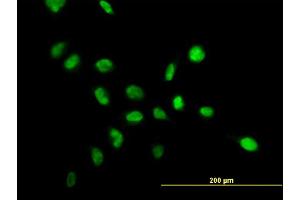 Immunofluorescence of monoclonal antibody to NPM1 on HeLa cell. (NPM1 antibody  (AA 1-294))