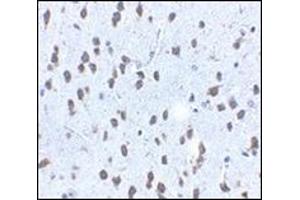 Immunohistochemistry of SCF in mouse brain tissue with this product at 2. (KIT Ligand antibody  (Center))