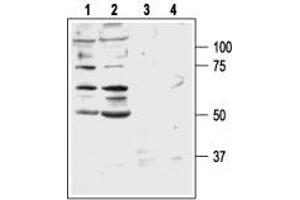Western blot analysis of DU 145 (lanes 1 and 3) and PC-3 (lanes 2 and 4) human prostate carcinoma cell lines: - 1,2. (GRPR antibody  (3rd Extracellular Loop))