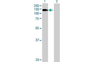 Western Blotting (WB) image for anti-Budding Uninhibited By Benzimidazoles 1 Homolog (Yeast) (BUB1) (AA 1-1085) antibody (ABIN513834)