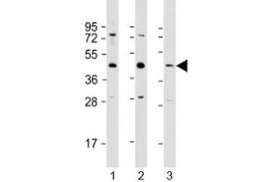 Western blot testing of 1) human HeLa, 2) human A549 and 3) mouse brain lysate with G6PC3 antibody at 1:1000.