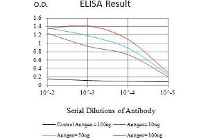 Black line: Control Antigen (100 ng),Purple line: Antigen (10 ng), Blue line: Antigen (50 ng), Red line:Antigen (100 ng) (S100B antibody  (AA 1-92))