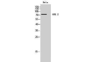 Western Blotting (WB) image for anti-Adrenergic, Beta, Receptor Kinase 1 (ADRBK1) (Ser129) antibody (ABIN3175426) (GRK2 antibody  (Ser129))