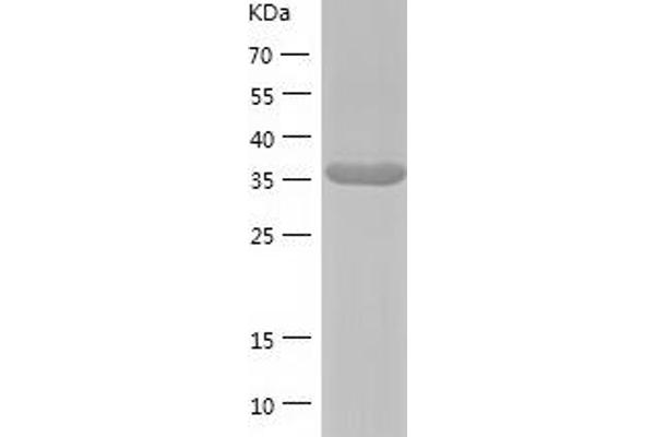 PRPSAP2 Protein (AA 1-369) (His tag)