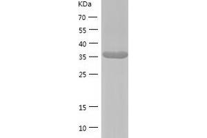 Western Blotting (WB) image for phosphoribosyl Pyrophosphate Synthetase-Associated Protein 2 (PRPSAP2) (AA 1-369) protein (His tag) (ABIN7124442) (PRPSAP2 Protein (AA 1-369) (His tag))