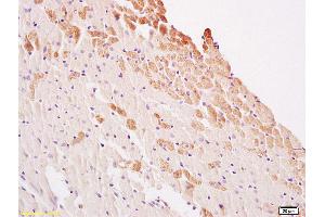 Formalin-fixed and paraffin embedded rat heart labeled with Anti LATS2 Polyclonal Antibody, Unconjugated (ABIN753553) at 1:200 followed by conjugation to the secondary antibody and DAB staining (LATS1,2 (AA 641-740) antibody)