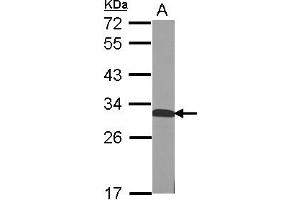 Image no. 1 for anti-Quinoid Dihydropteridine Reductase (QDPR) (AA 1-244) antibody (ABIN1501905) (QDPR antibody  (AA 1-244))