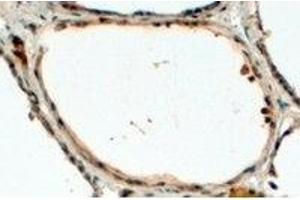 AP23774PU-N DUOX1 antibody staining of paraffin embedded Human Thyroid Gland at 4 µg/ml. (DUOX1 antibody  (Internal Region))