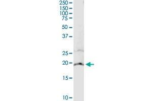 Immunoprecipitation (IP) image for anti-Cytochrome B5 Type A (Microsomal) (CYB5A) (AA 1-134) antibody (ABIN514806)