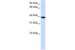 KLHDC8B antibody used at 1 ug/ml to detect target protein. (KLHDC8B antibody  (Middle Region))