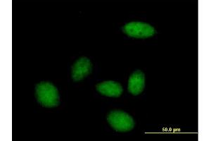 Immunofluorescence of purified MaxPab antibody to ZHX3 on HeLa cell. (ZHX3 antibody  (AA 1-969))